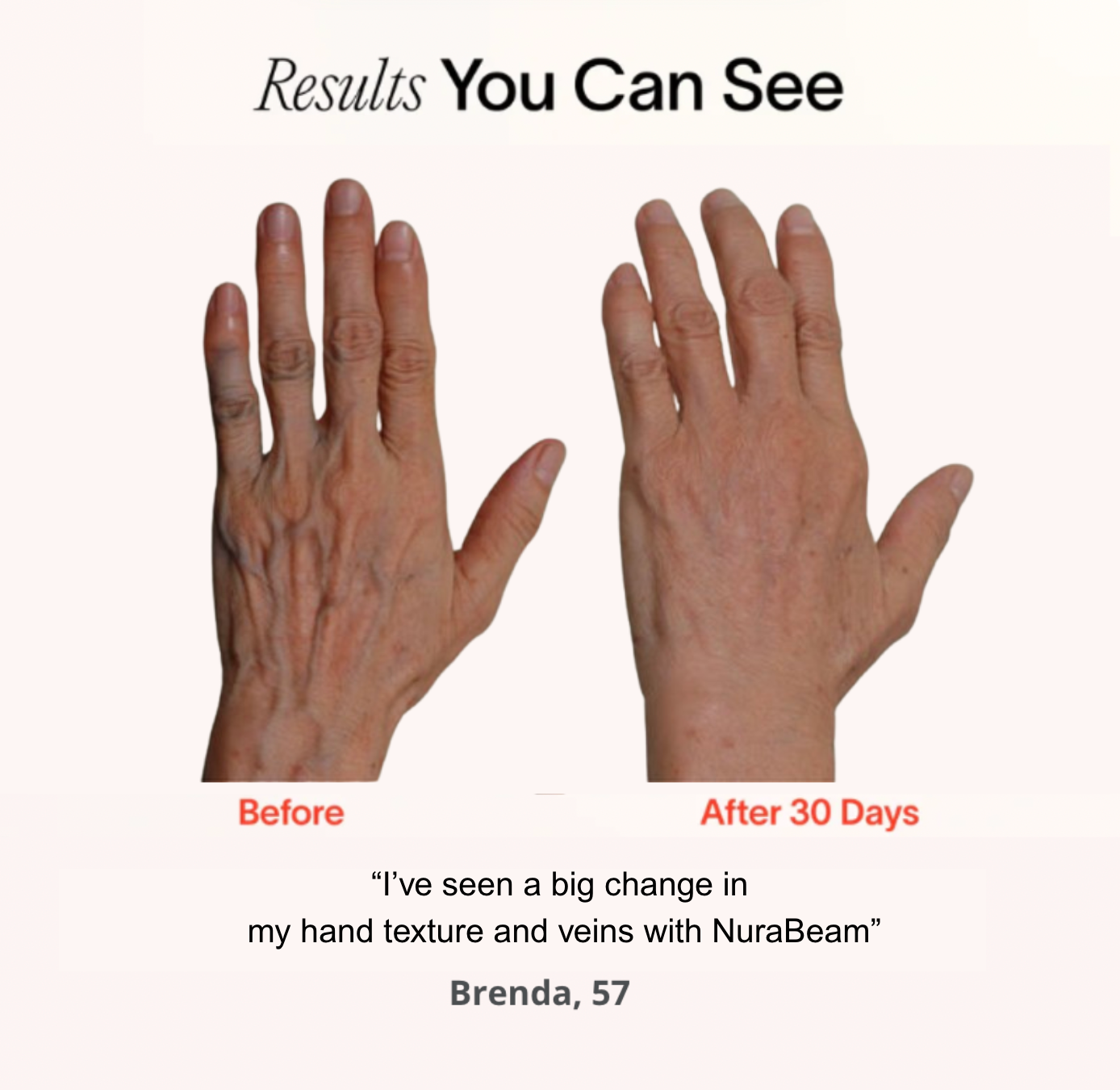 NuraSculpt™ Hand Glove