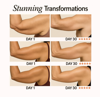 NuraSculpt™ Arm Bands