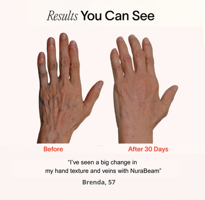NuraSculpt™ Hand Glove